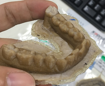 打印牙齿模型 打印牙齿模型